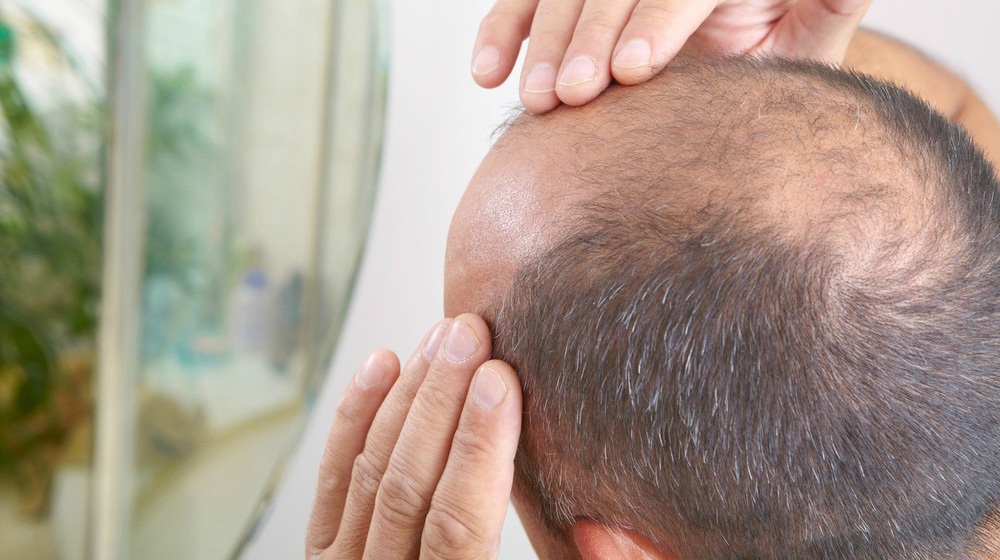 What is stem cell therapy? Does it work for hair loss?